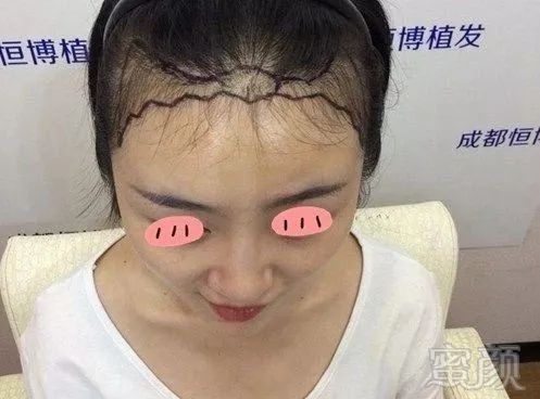 https://img.miyanlife.com/mnt/timg/191206/1402302960-0.jpg