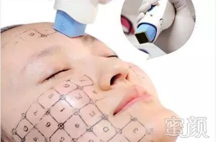 https://img.miyanlife.com/mnt/timg/191206/141I5MG-6.jpg