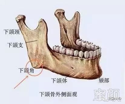 案例图片