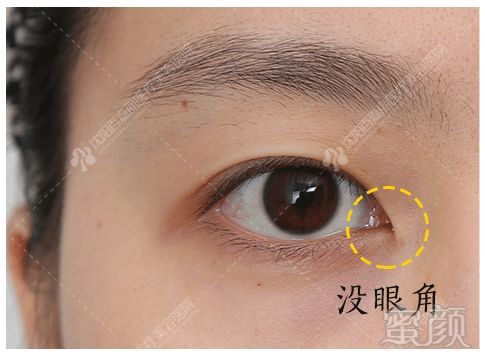 https://img.miyanlife.com/mnt/timg/191207/1406095c1-3.jpg