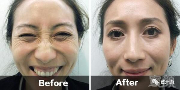 https://img.miyanlife.com/mnt/timg/191207/14132JS4-11.jpg