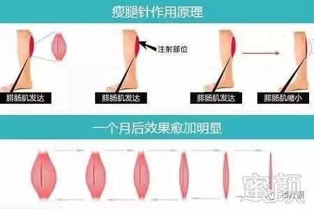 https://img.miyanlife.com/mnt/timg/191207/14132T195-14.jpg