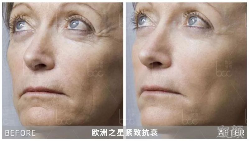 https://img.miyanlife.com/mnt/timg/191210/135513E40-12.jpg