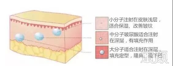 https://img.miyanlife.com/mnt/timg/191210/135Q13b2-3.jpg