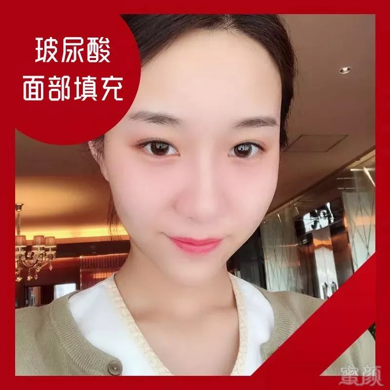 https://img.miyanlife.com/mnt/timg/191210/135Q360J-6.jpg