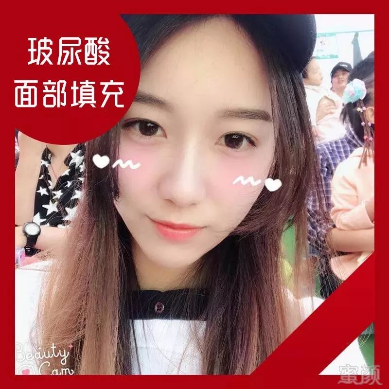 https://img.miyanlife.com/mnt/timg/191210/135Q453I-7.jpg