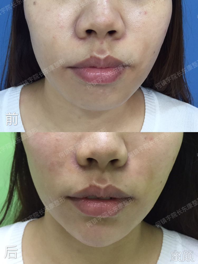 https://img.miyanlife.com/mnt/timg/191210/135QCG5-12.jpg