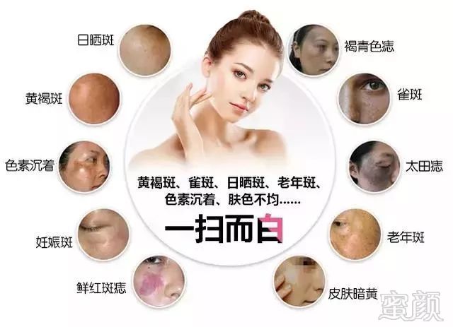 https://img.miyanlife.com/mnt/timg/191211/14552B947-7.jpg