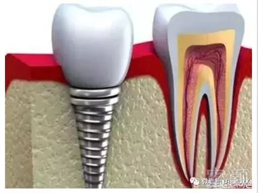 https://img.miyanlife.com/mnt/timg/191213/13203QD7-0.jpg