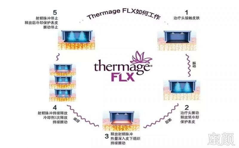 https://img.miyanlife.com/mnt/timg/191214/1231421337-5.jpg