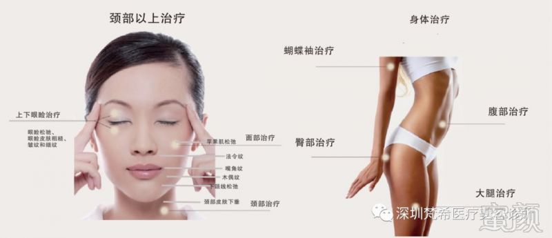 https://img.miyanlife.com/mnt/timg/191214/1231432306-6.jpg