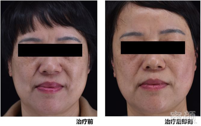 https://img.miyanlife.com/mnt/timg/191214/12314CN9-9.jpg