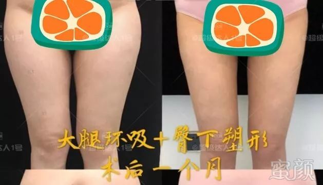 https://img.miyanlife.com/mnt/timg/191214/134U23X0-3.jpg