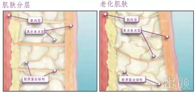 https://img.miyanlife.com/mnt/timg/191215/1226321N2-3.jpg