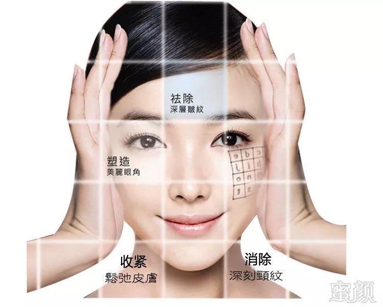 https://img.miyanlife.com/mnt/timg/191215/1321251236-0.jpg