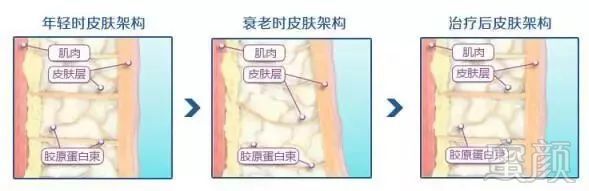 https://img.miyanlife.com/mnt/timg/191215/13212HA1-2.jpg