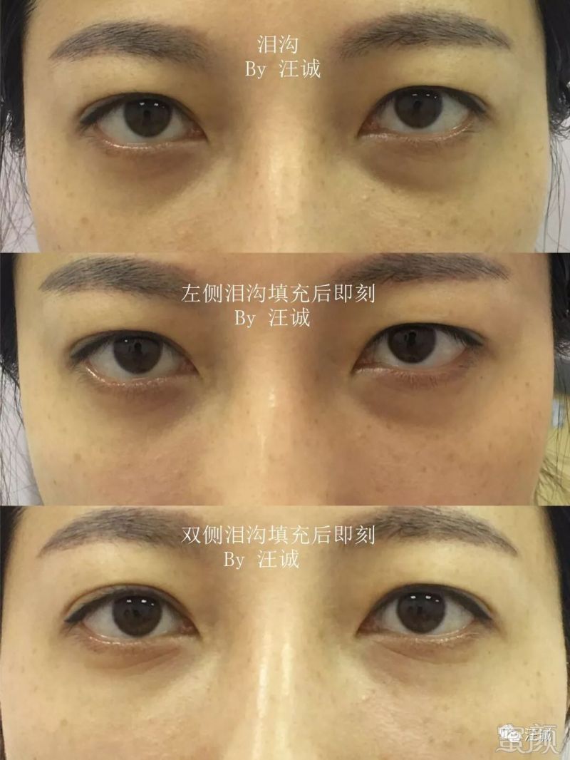 https://img.miyanlife.com/mnt/timg/191216/124A12295-1.jpg