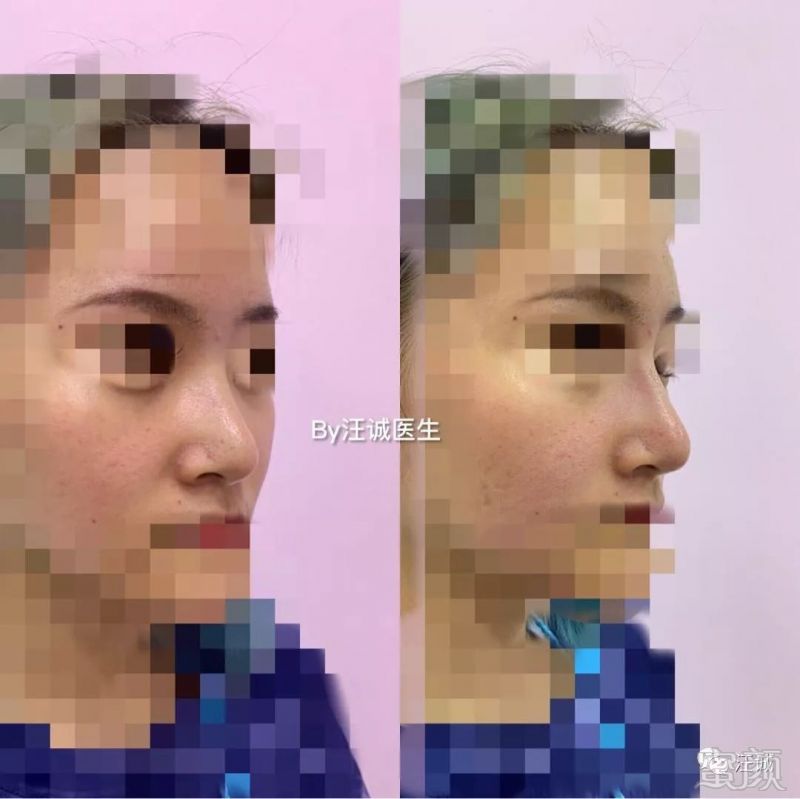https://img.miyanlife.com/mnt/timg/191216/124A1D05-0.jpg