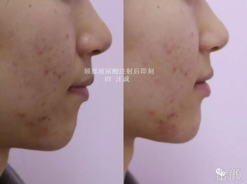 https://img.miyanlife.com/mnt/timg/191216/124A3A19-2.jpg