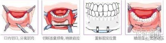 案例图片