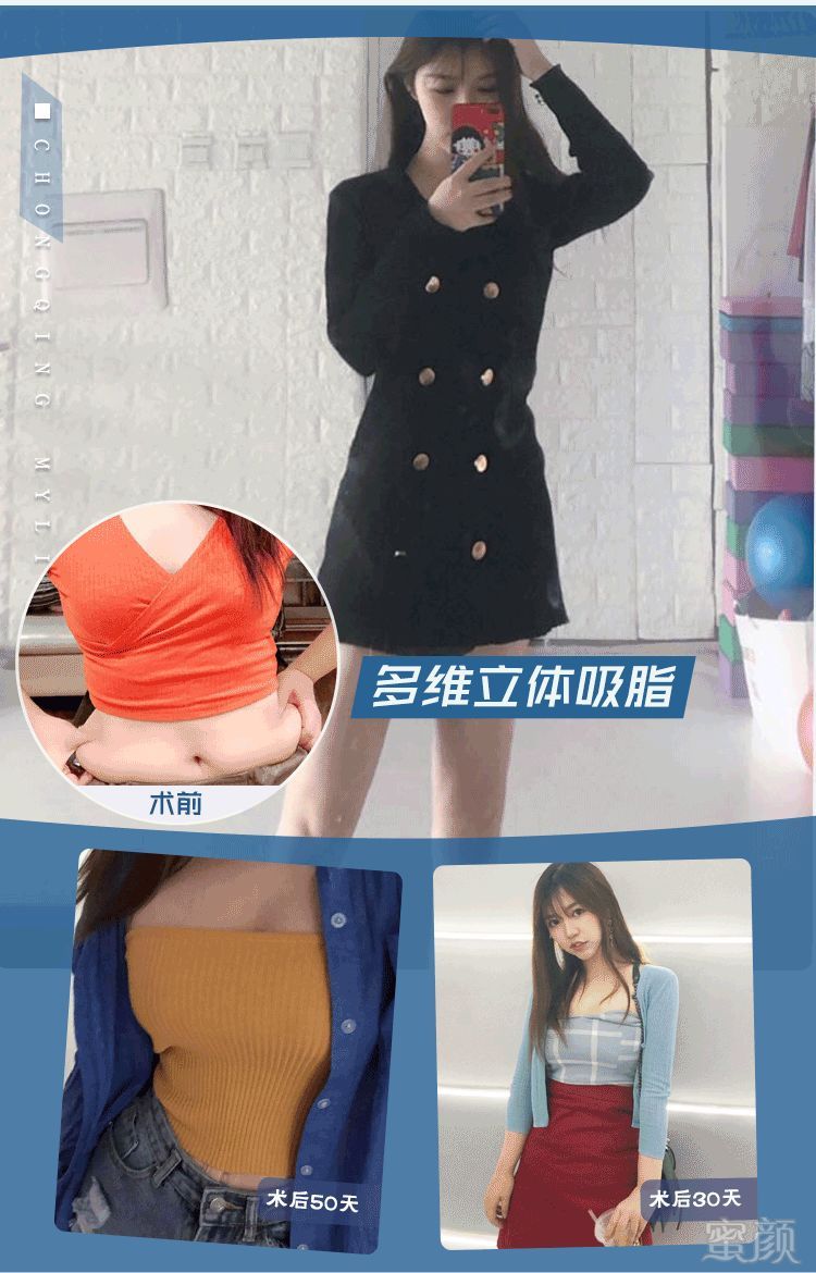 https://img.miyanlife.com/mnt/timg/191217/1356303238-4.jpg