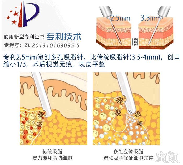 https://img.miyanlife.com/mnt/timg/191217/1356306232-3.jpg
