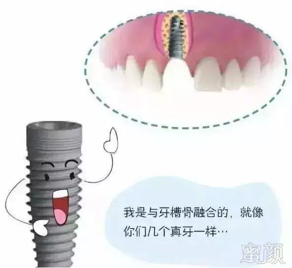 https://img.miyanlife.com/mnt/timg/191217/13591V515-9.jpg