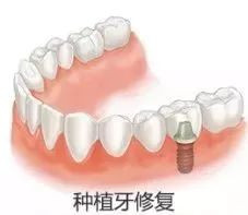 https://img.miyanlife.com/mnt/timg/191217/14252M551-10.jpg