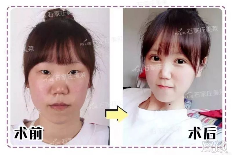 https://img.miyanlife.com/mnt/timg/191217/1559491209-7.jpg