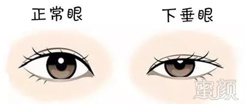 https://img.miyanlife.com/mnt/timg/191217/155951K48-9.jpg