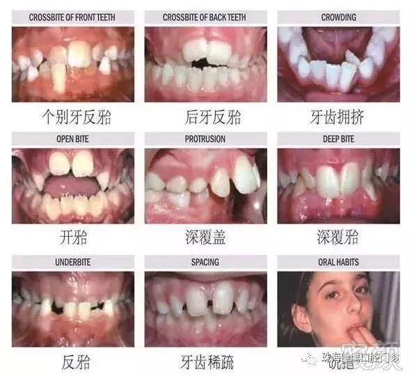https://img.miyanlife.com/mnt/timg/191217/155G93293-3.jpg