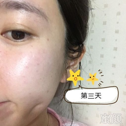 https://img.miyanlife.com/mnt/timg/191217/162PI313-5.jpg
