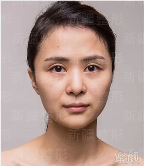 https://img.miyanlife.com/mnt/timg/191217/1J63A3R-5.jpg