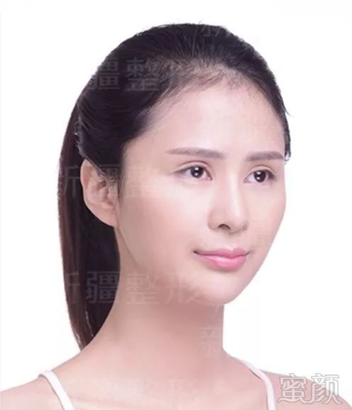 https://img.miyanlife.com/mnt/timg/191217/1J63S414-8.jpg