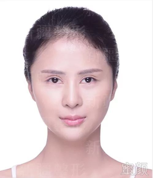 https://img.miyanlife.com/mnt/timg/191217/1J63T0a-6.jpg