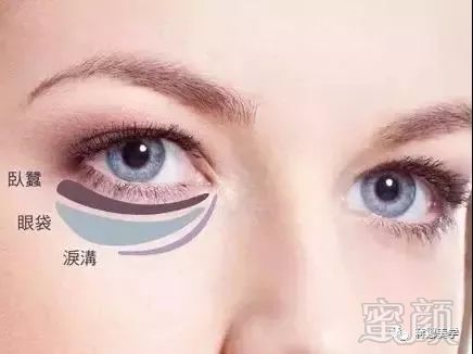 https://img.miyanlife.com/mnt/timg/191217/1JA62025-0.jpg