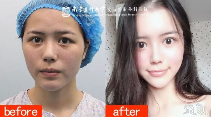 https://img.miyanlife.com/mnt/timg/191218/12542L914-4.jpg