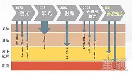 案例图片