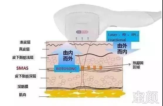 案例图片