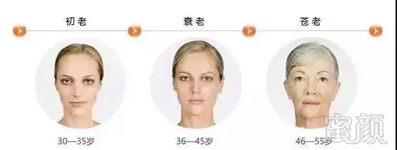 https://img.miyanlife.com/mnt/timg/191218/14022L162-6.jpg