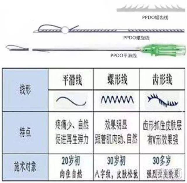 案例图片