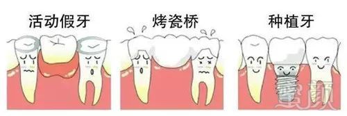 https://img.miyanlife.com/mnt/timg/191218/1IQ62039-2.jpg