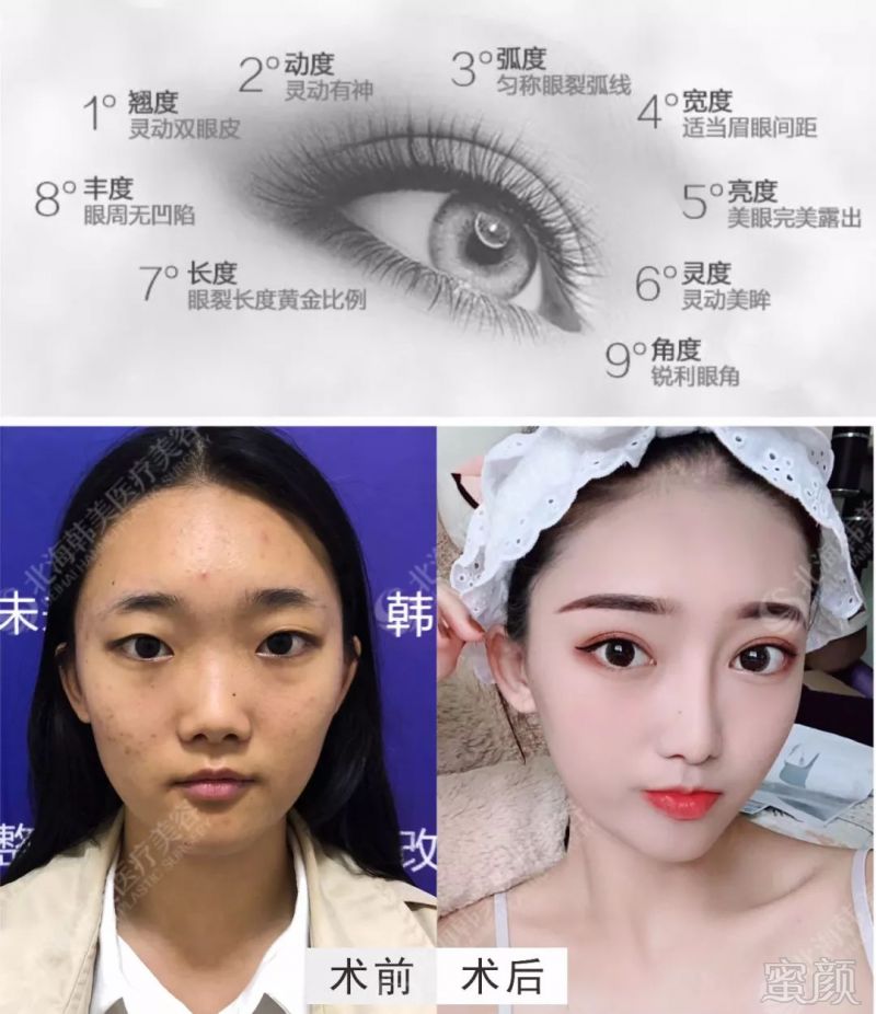 https://img.miyanlife.com/mnt/timg/191219/1A5462V7-0.jpg