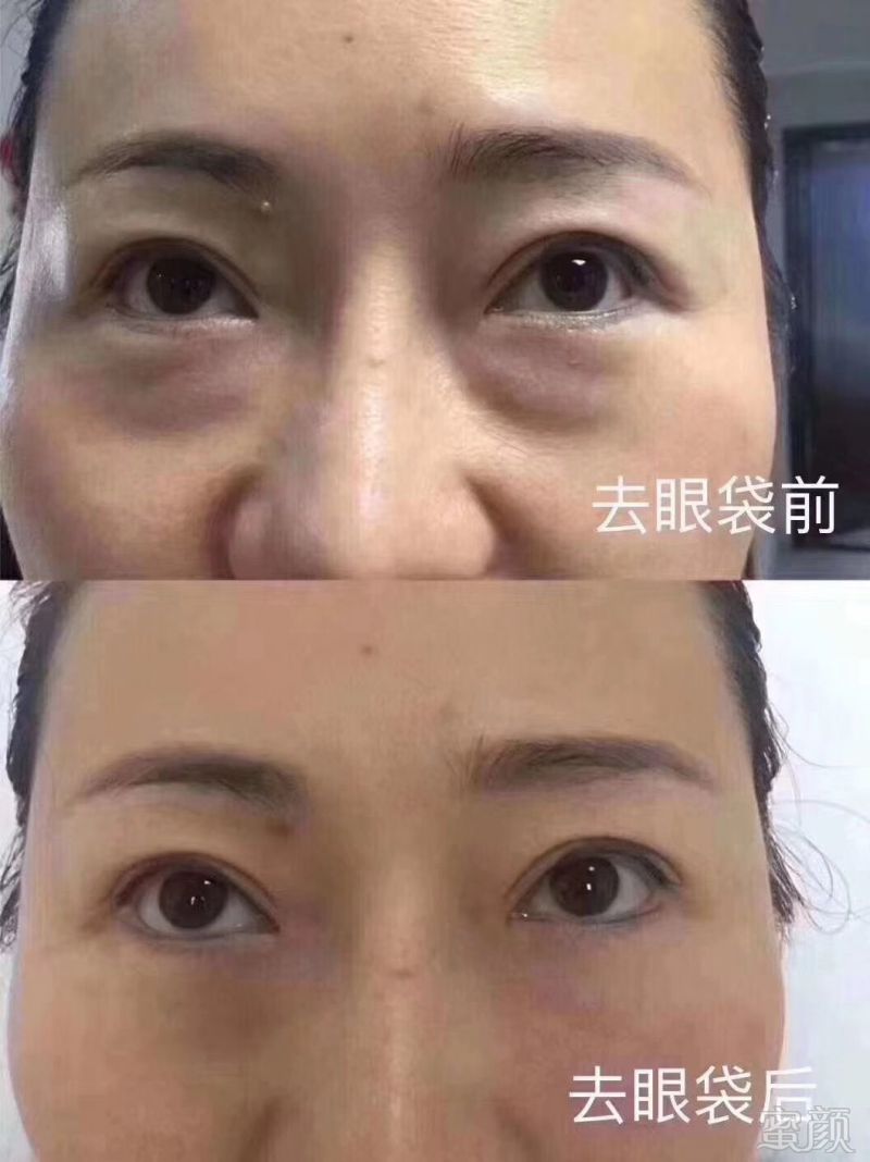 https://img.miyanlife.com/mnt/timg/191219/1A5492040-3.jpg