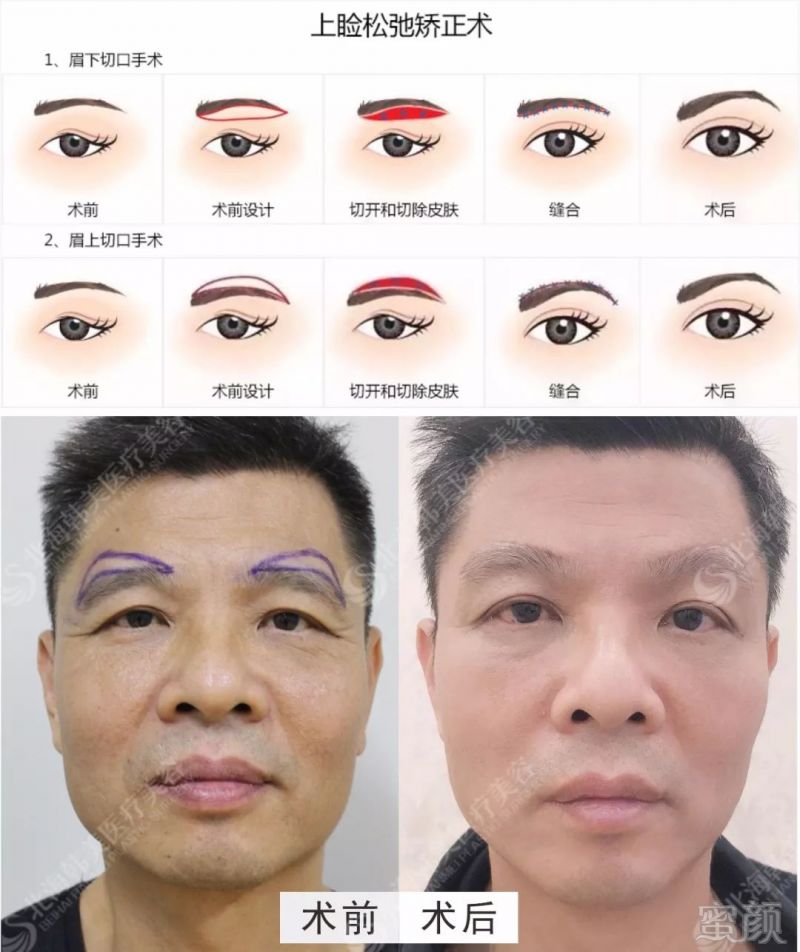 https://img.miyanlife.com/mnt/timg/191219/1A54K1Y-1.jpg