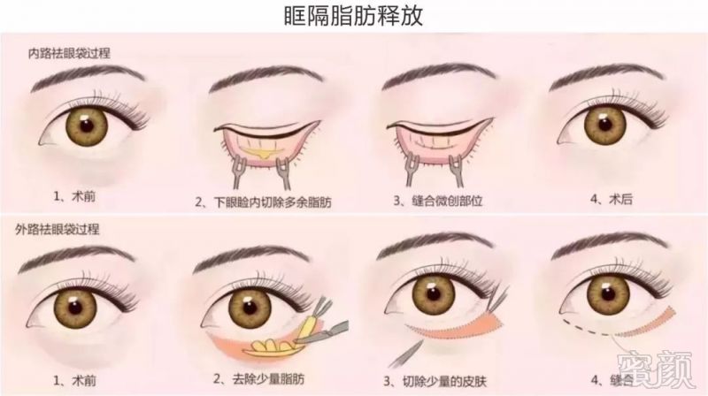 https://img.miyanlife.com/mnt/timg/191219/1A54U236-2.jpg