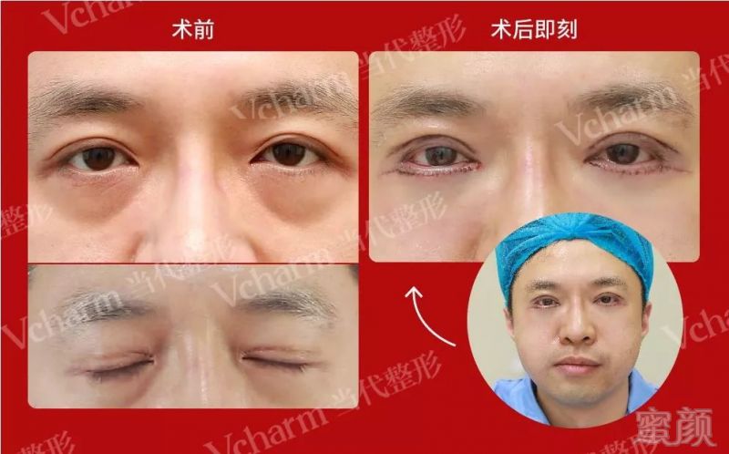 https://img.miyanlife.com/mnt/timg/191219/1AT335L-1.jpg
