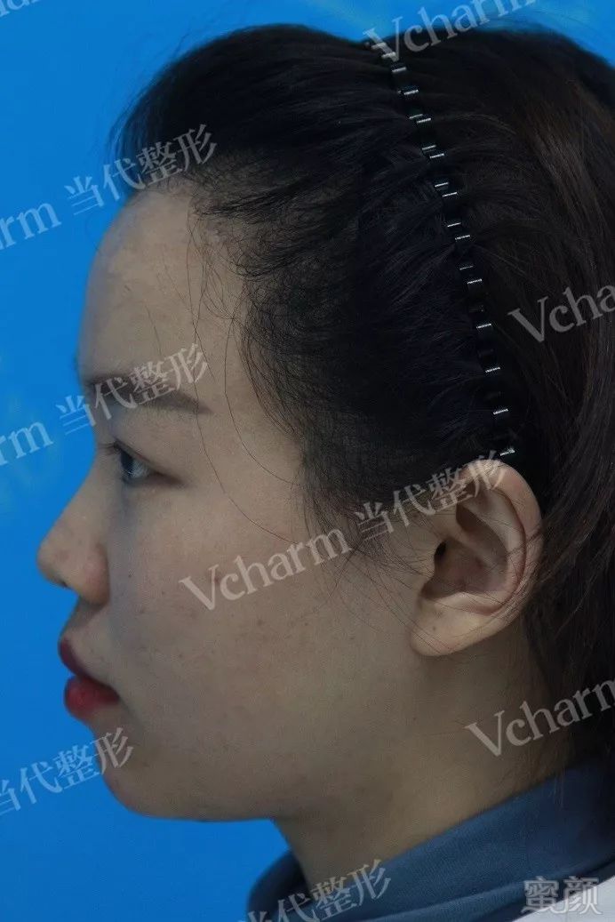 https://img.miyanlife.com/mnt/timg/191219/1ATVT0-8.jpg