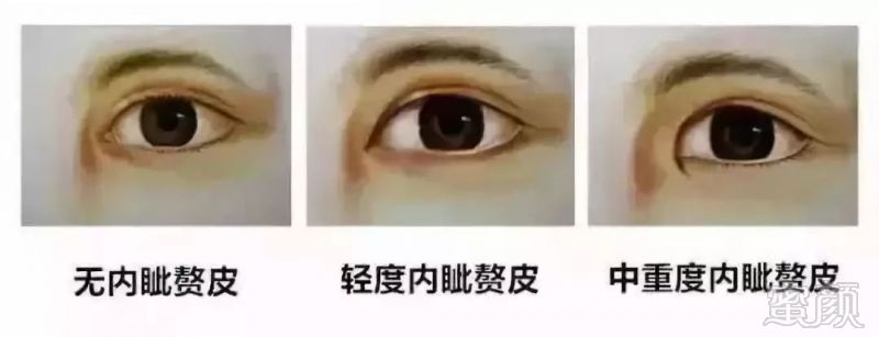 https://img.miyanlife.com/mnt/timg/191219/1AU21033-1.jpg