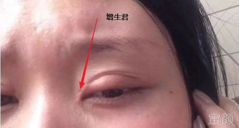 https://img.miyanlife.com/mnt/timg/191219/1F5461637-2.jpg